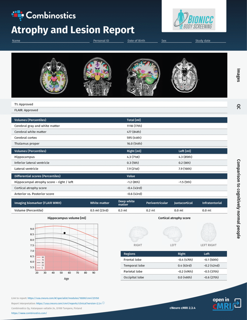 Sample brain health scan reports